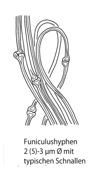 Gestreifter Teuerling