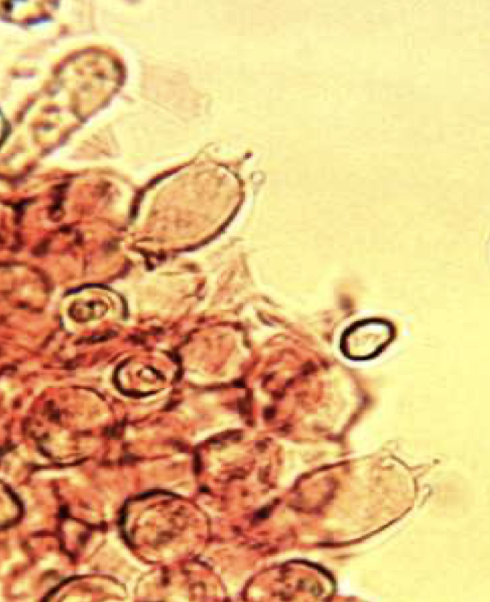 LeucocoprinusCepistipes8