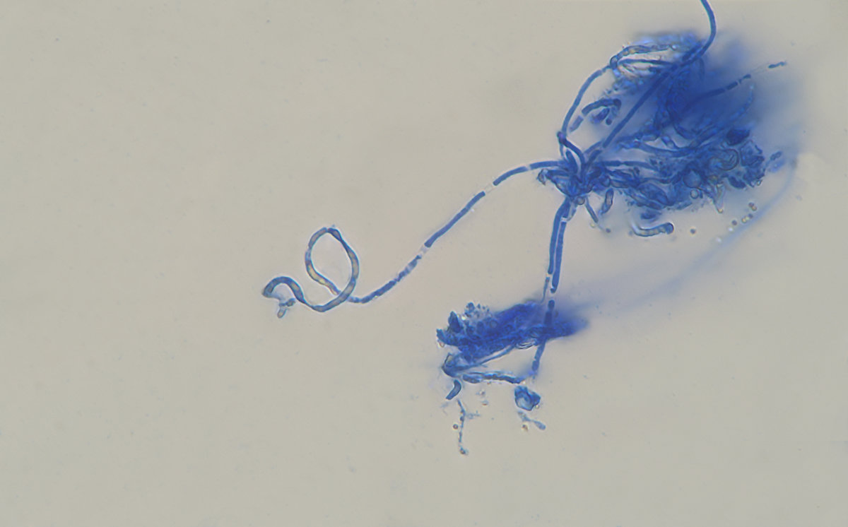 Gelber Spateling (Spathularia flavida) Paraphysen