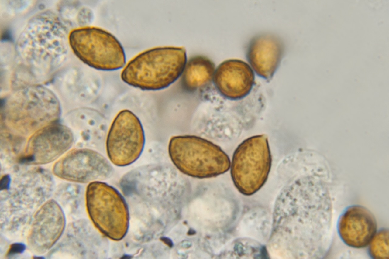 Gelber Spateling (Spathularia flavida) Sporen