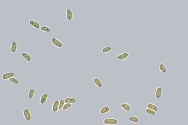 Rosafarbene Saftporling (Rhodonia placenta) - Sporen